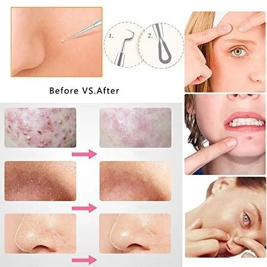 8-Pack: Professional Skin Care Kit