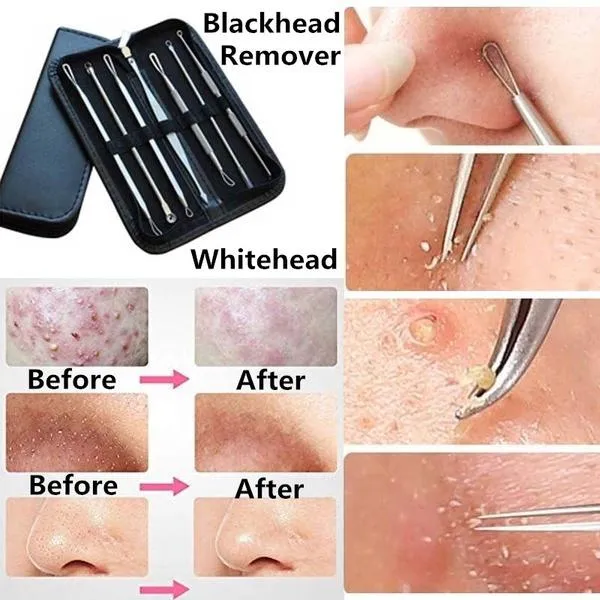 8-Pack: Professional Skin Care Kit